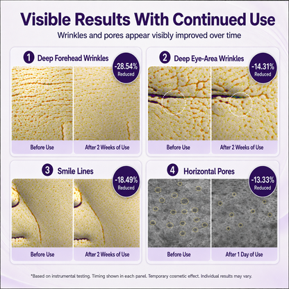 Mirevyn Instant Lift Face Tightener