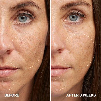 Aurawhispers✨Last day of promotion💧 Brightening Serum-Helps improve dull skin texture and leaves appearance brighter.