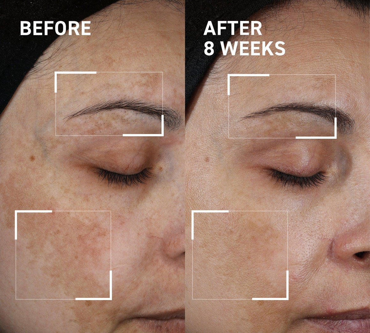 Aurawhispers✨Last day of promotion💧 Brightening Serum-Helps improve dull skin texture and leaves appearance brighter.