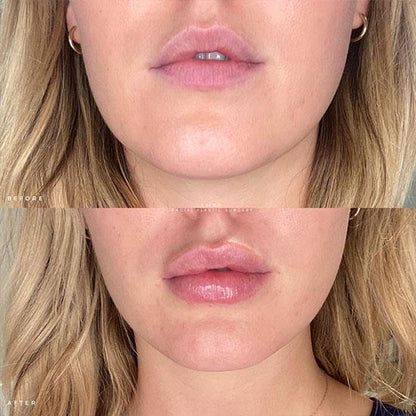 NESLEMY ✨ BUY MORE, GET MORE 👄Hydrating Collagen Mouth Tape