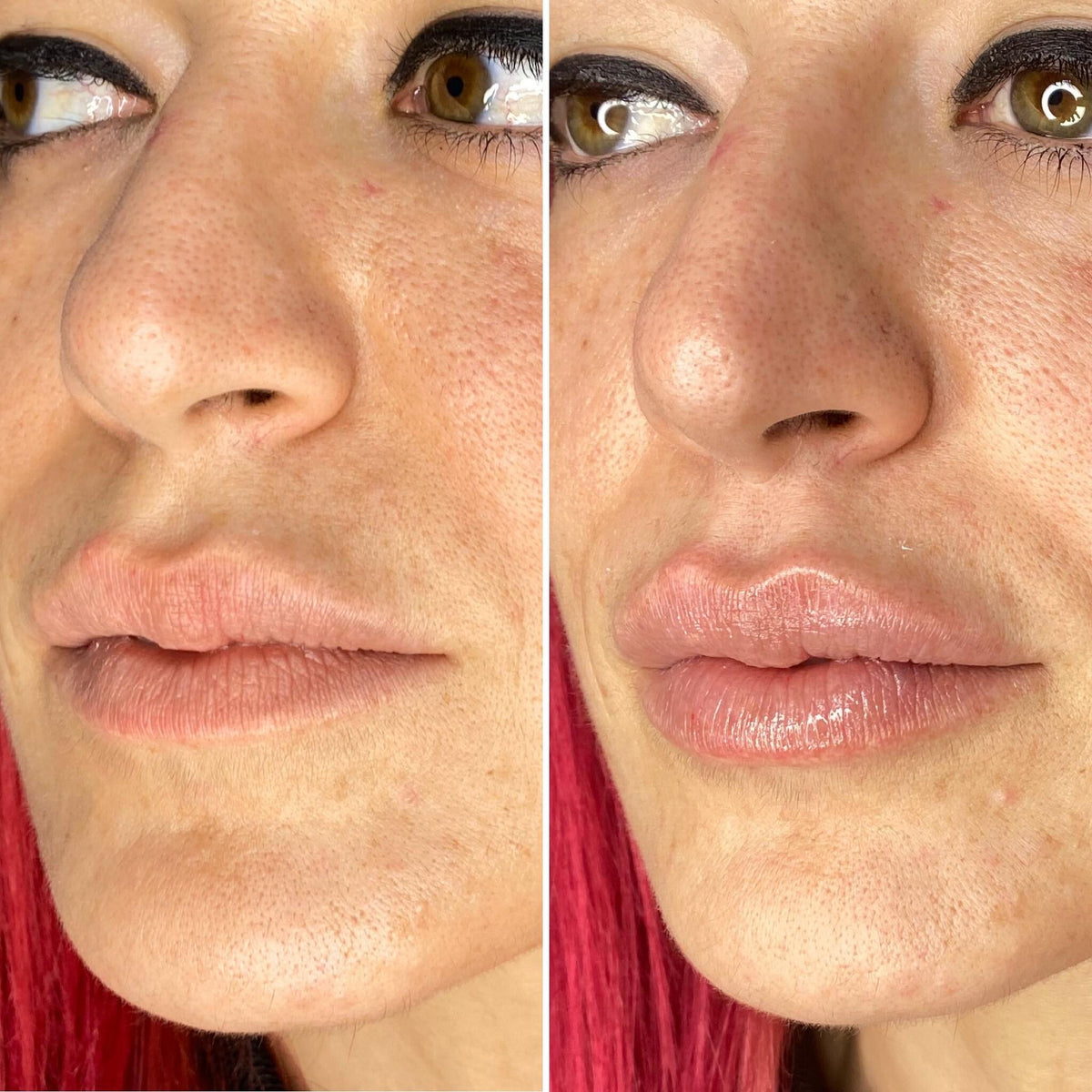 NESLEMY ✨ BUY MORE, GET MORE 👄Hydrating Collagen Mouth Tape